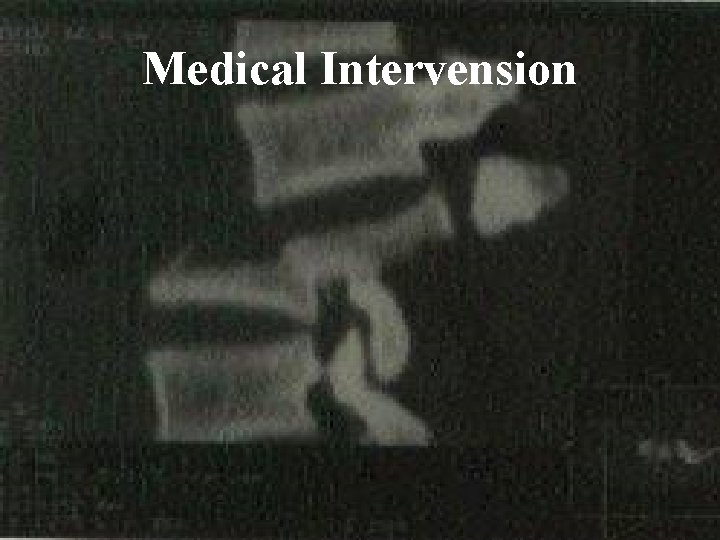 Medical Intervension 