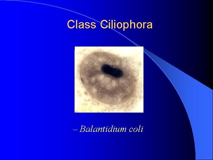 Class Ciliophora – Balantidium coli 