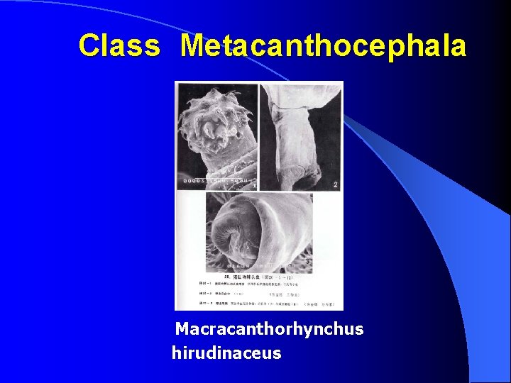 Class Metacanthocephala Macracanthorhynchus hirudinaceus 