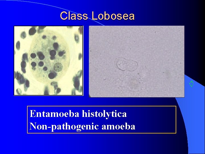 Class Lobosea Entamoeba histolytica Non-pathogenic amoeba 