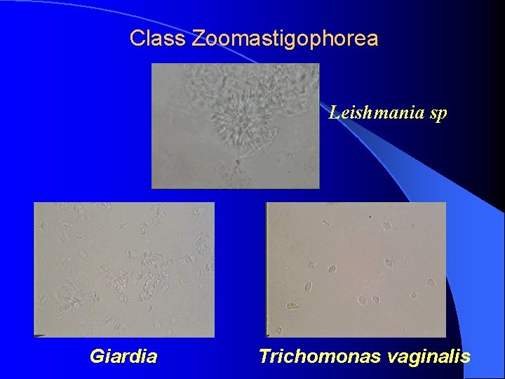 Class Zoomastigophorea Leishmania sp Giardia Trichomonas vaginalis 