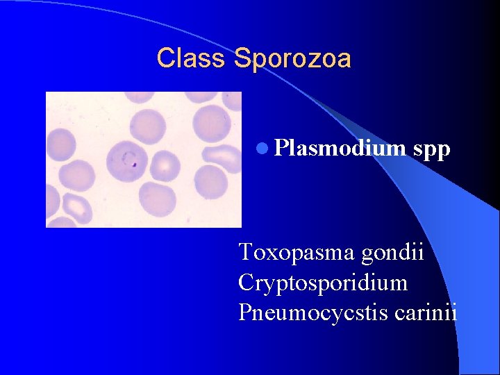 Class Sporozoa l Plasmodium spp Toxopasma gondii Cryptosporidium Pneumocycstis carinii 