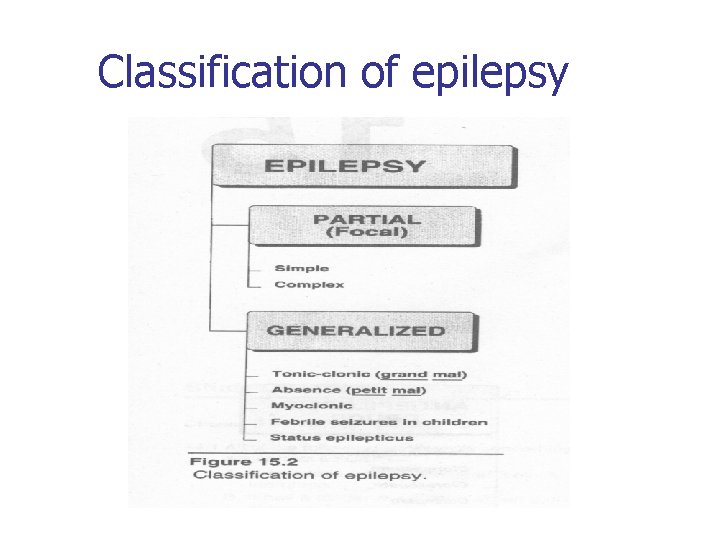 Classification of epilepsy 