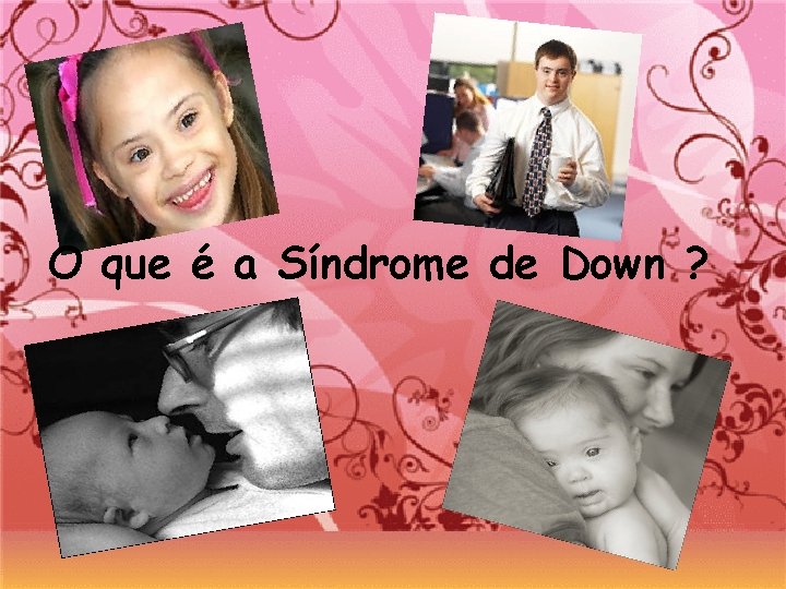 O que é a Síndrome de Down ? 
