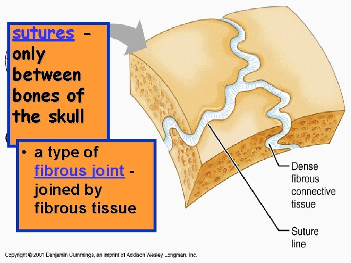 sutures only between bones of the skull • a type of fibrous joint joined