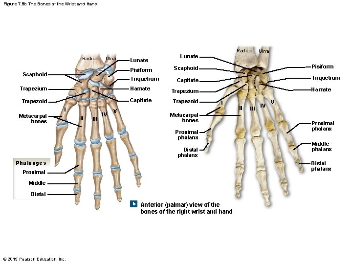 Figure 7. 8 b The Bones of the Wrist and Hand Radius Ulna Lunate Figure 7. 8 b The Bones of the Wrist and Hand Radius Ulna Lunate