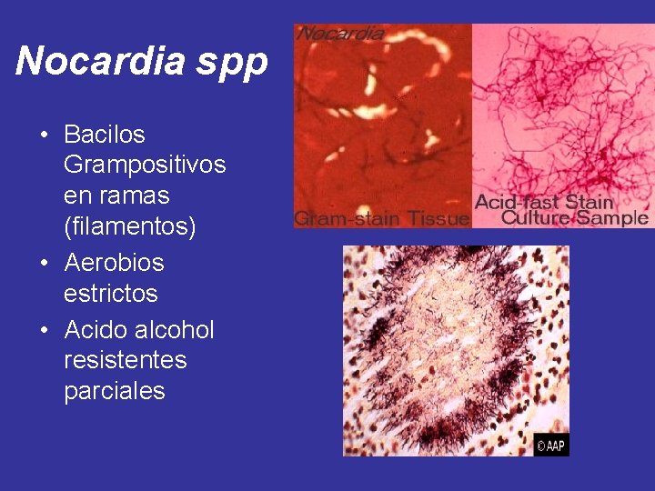 Nocardia spp • Bacilos Grampositivos en ramas (filamentos) • Aerobios estrictos • Acido alcohol