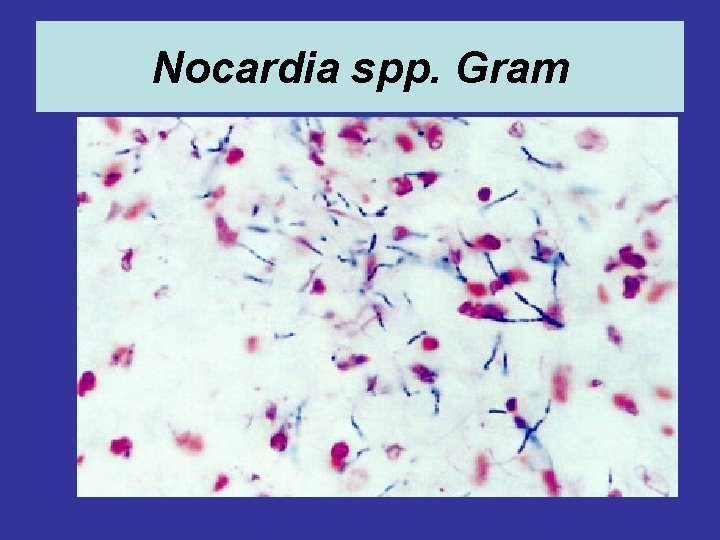 Nocardia spp. Gram 