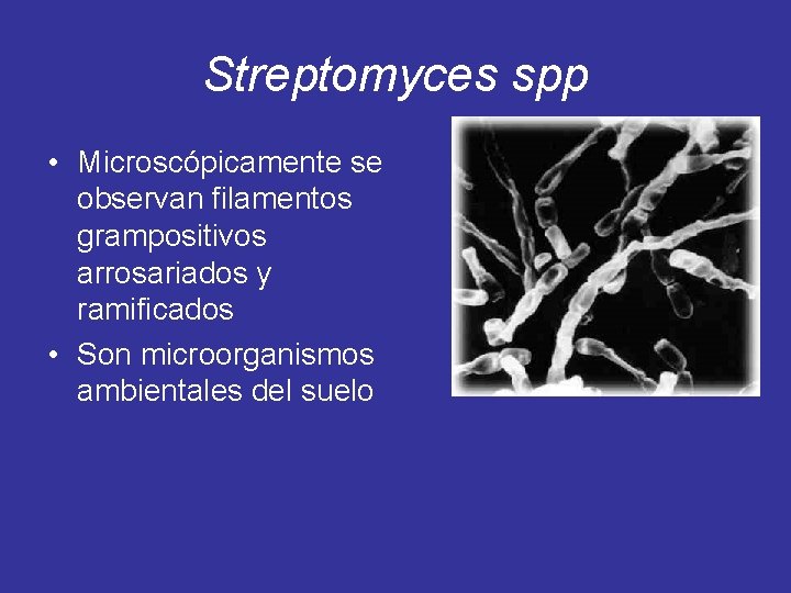 Streptomyces spp • Microscópicamente se observan filamentos grampositivos arrosariados y ramificados • Son microorganismos