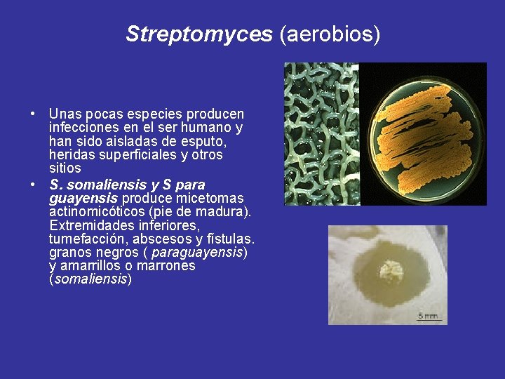 Streptomyces (aerobios) • Unas pocas especies producen infecciones en el ser humano y han