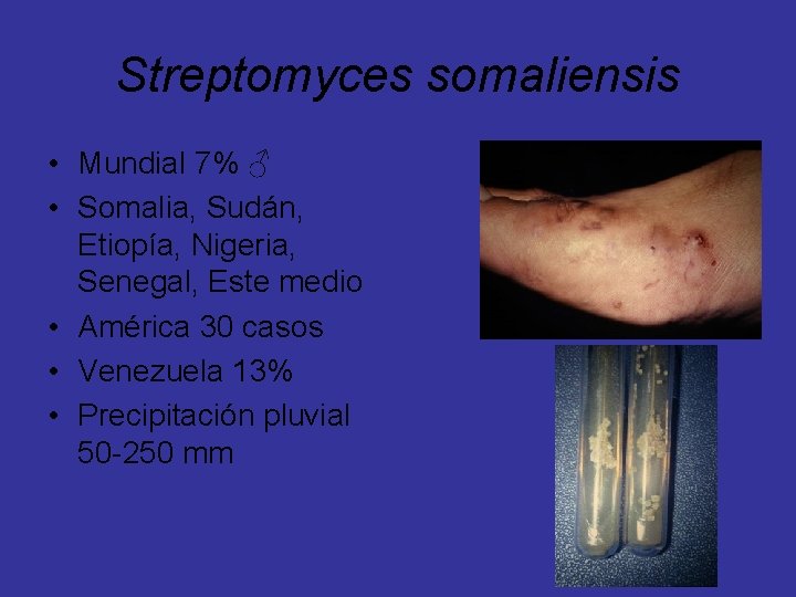Streptomyces somaliensis • Mundial 7% ♂ • Somalia, Sudán, Etiopía, Nigeria, Senegal, Este medio
