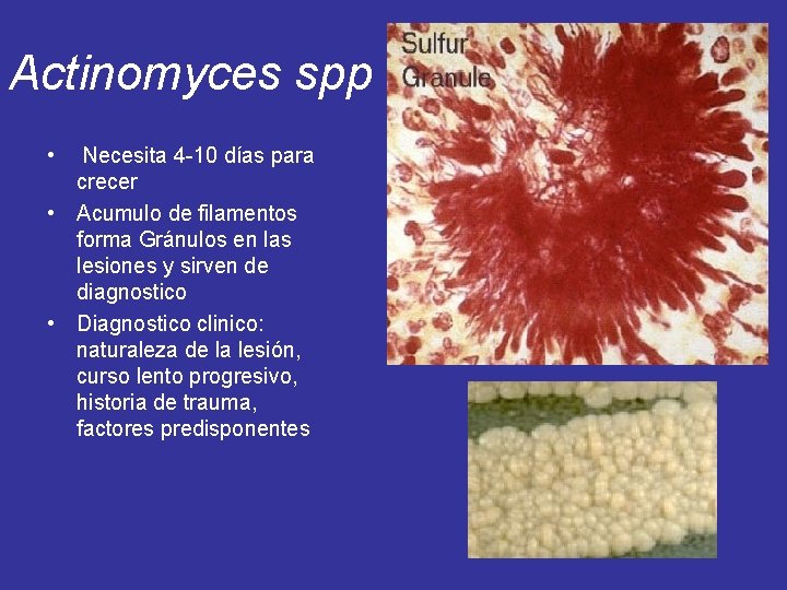 Actinomyces spp • Necesita 4 -10 días para crecer • Acumulo de filamentos forma