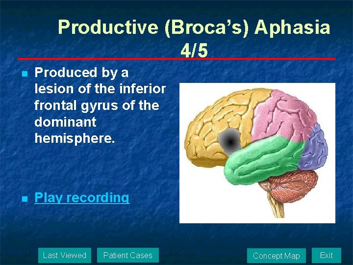 Productive (Broca’s) Aphasia 4/5 n Produced by a lesion of the inferior frontal gyrus