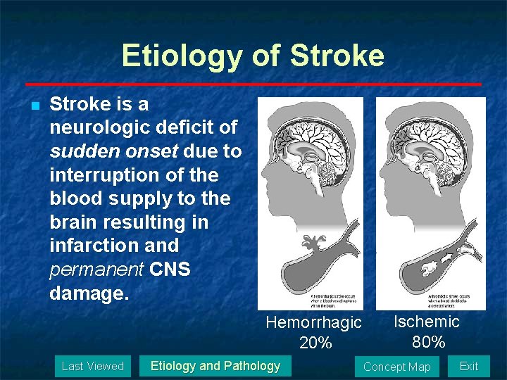 Etiology of Stroke n Stroke is a neurologic deficit of sudden onset due to