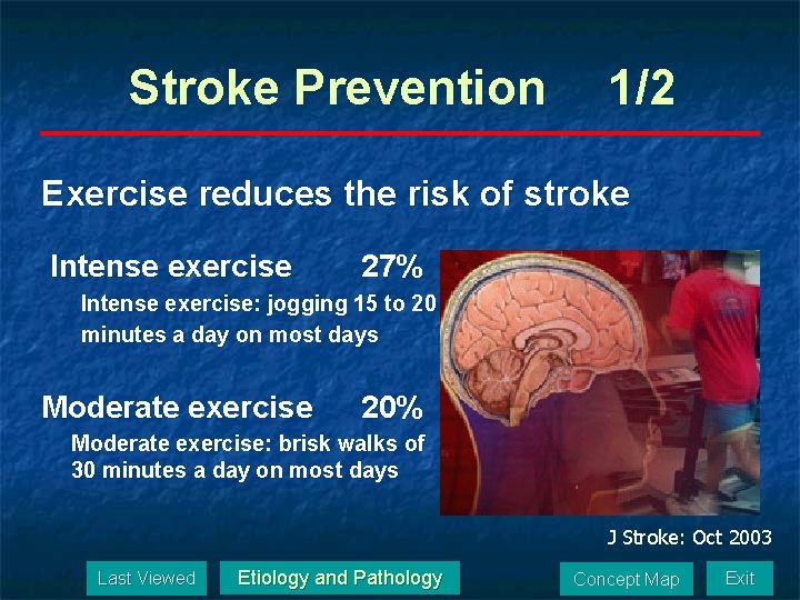 Stroke Prevention 1/2 Exercise reduces the risk of stroke Intense exercise 27% Intense exercise:
