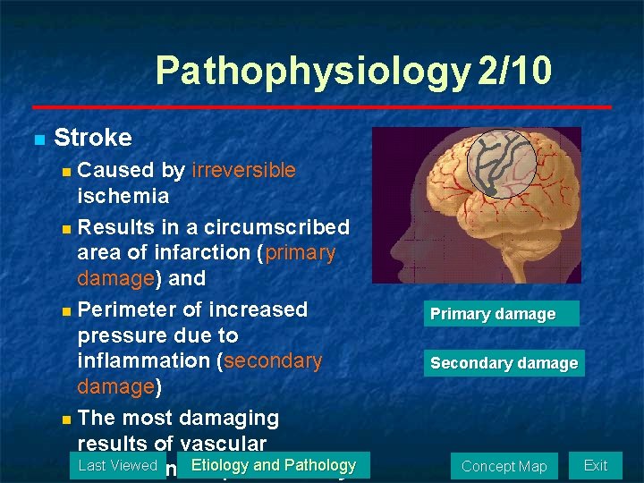 Pathophysiology 2/10 n Stroke n Caused by irreversible ischemia n Results in a circumscribed