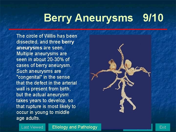Berry Aneurysms 9/10 The circle of Willis has been dissected, and three berry aneurysms