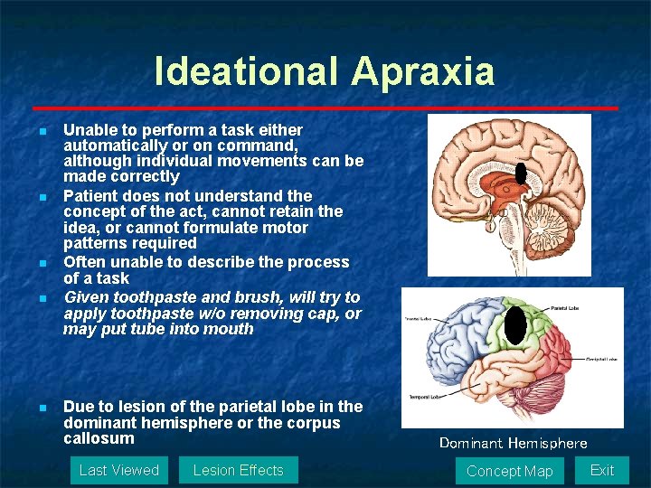 Ideational Apraxia n n n Unable to perform a task either automatically or on