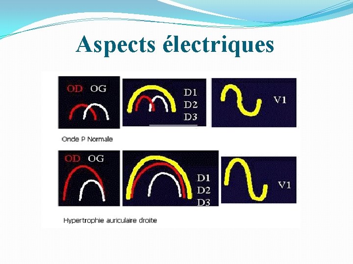 Aspects électriques 