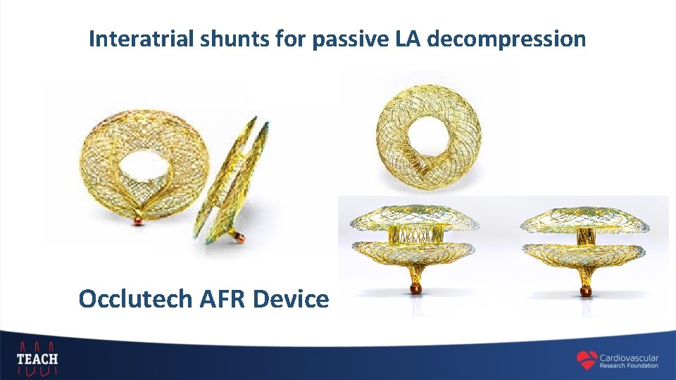 Interatrial shunts for passive LA decompression Occlutech AFR Device 