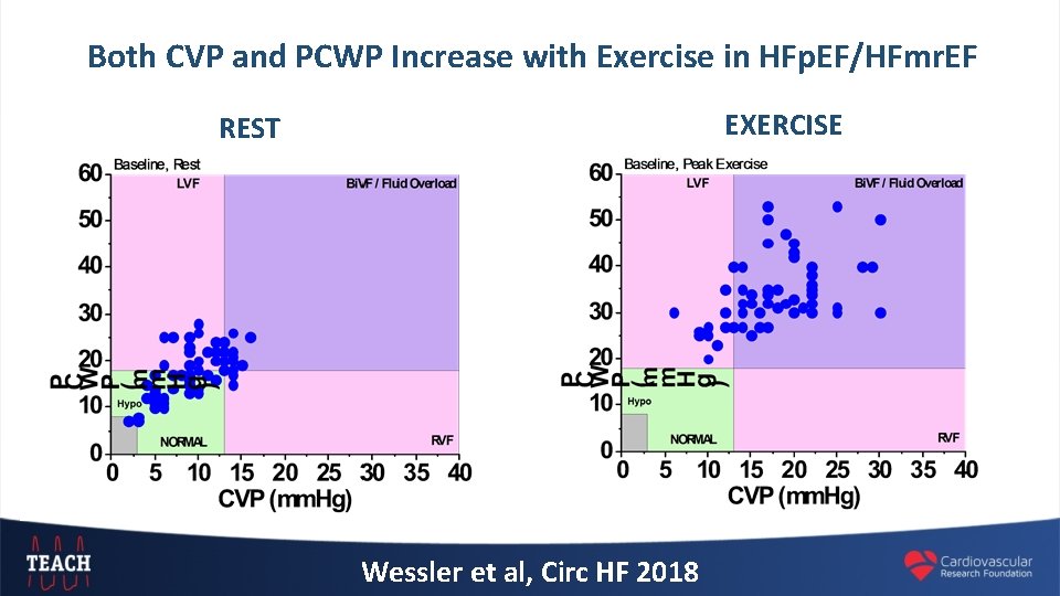 Both CVP and PCWP Increase with Exercise in HFp. EF/HFmr. EF EXERCISE REST Wessler