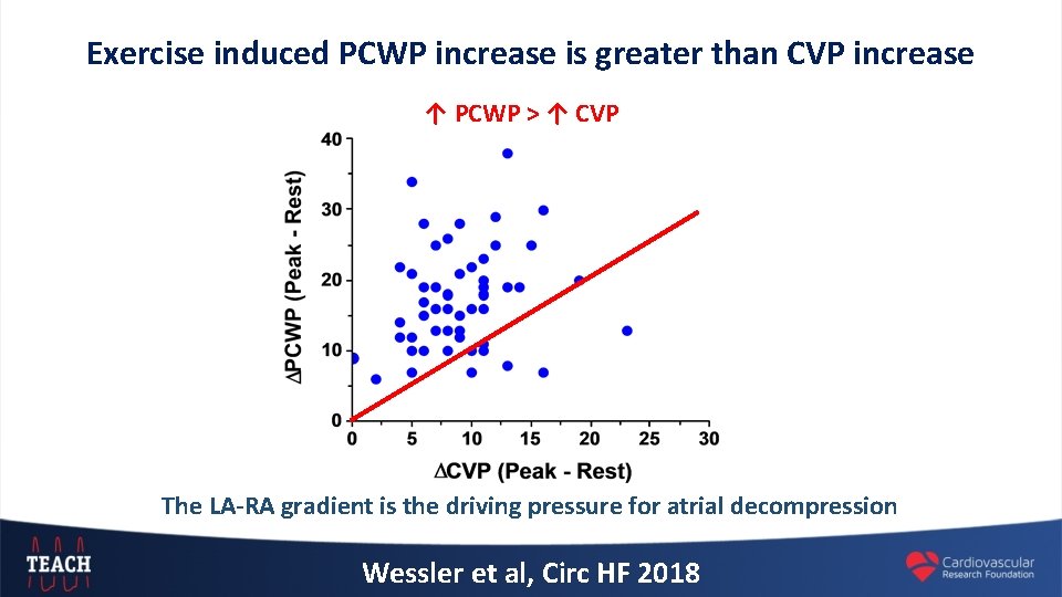 Exercise induced PCWP increase is greater than CVP increase ↑ PCWP > ↑ CVP