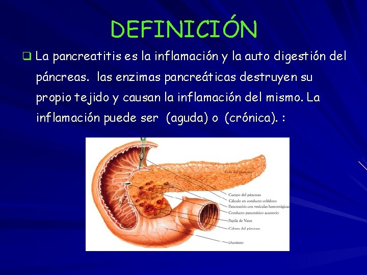 DEFINICIÓN q La pancreatitis es la inflamación y la auto digestión del páncreas. las