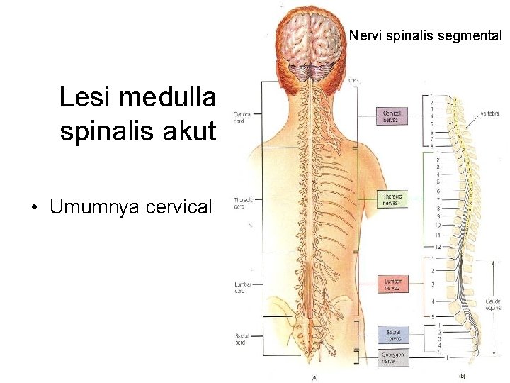 Nervi spinalis segmental Lesi medulla spinalis akut • Umumnya cervical Nervi spinalis segmental Lesi medulla spinalis akut • Umumnya cervical