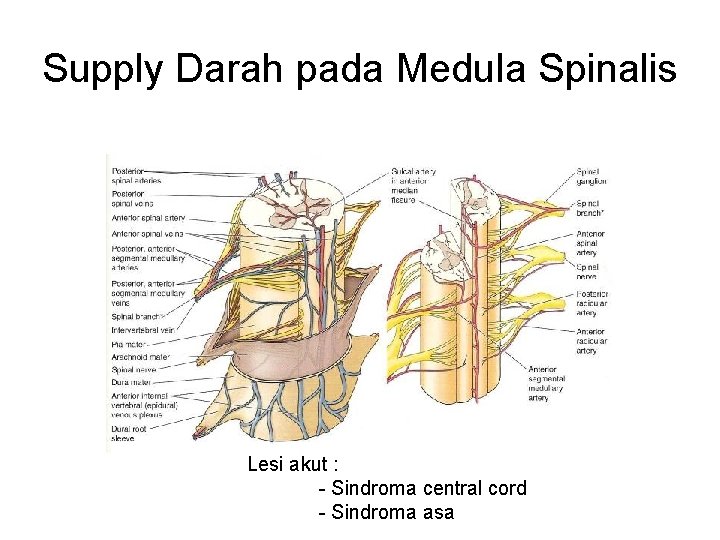 Supply Darah pada Medula Spinalis Lesi akut : - Sindroma central cord - Sindroma Supply Darah pada Medula Spinalis Lesi akut : - Sindroma central cord - Sindroma