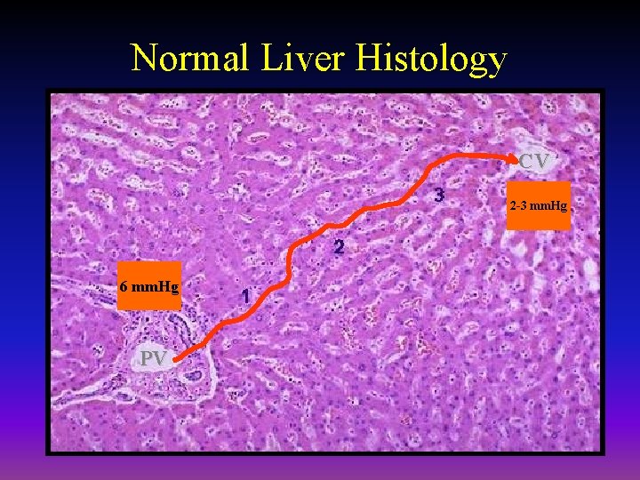 Normal Liver Histology CV 2 -3 mm. Hg 6 mm. Hg PV 