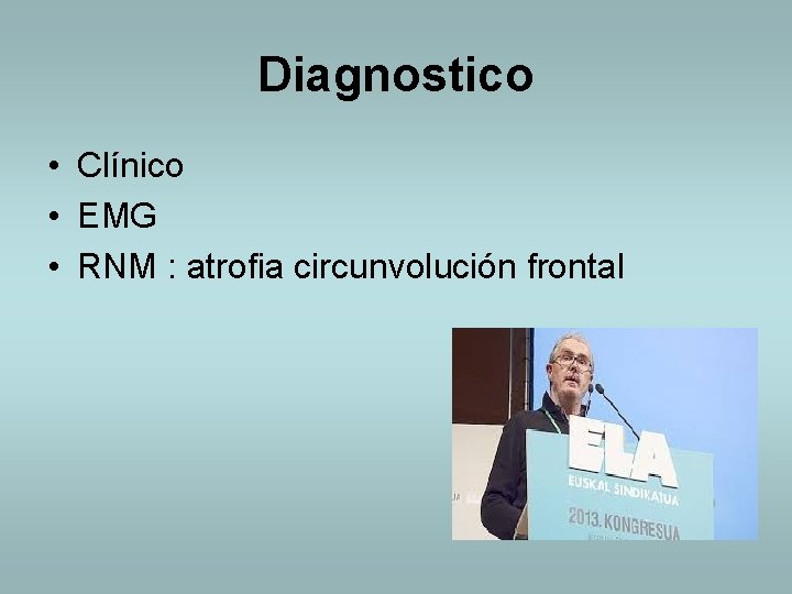 Diagnostico • Clínico • EMG • RNM : atrofia circunvolución frontal 