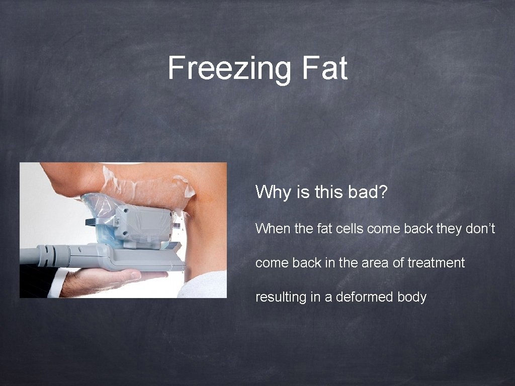 Freezing Fat Why is this bad? When the fat cells come back they don’t