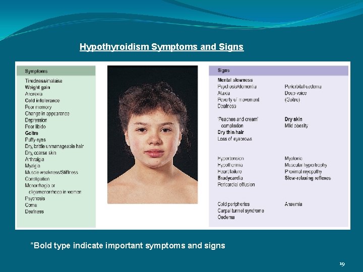 Hypothyroidism Symptoms and Signs *Bold type indicate important symptoms and signs 19 