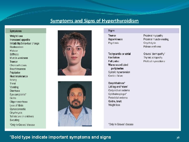 Symptoms and Signs of Hyperthyroidism *Bold type indicate important symptoms and signs 36 