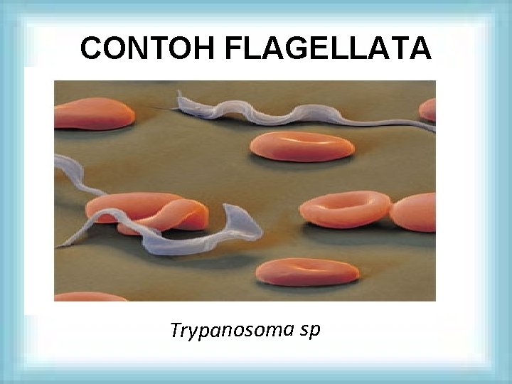 CONTOH FLAGELLATA Trypanosoma sp 