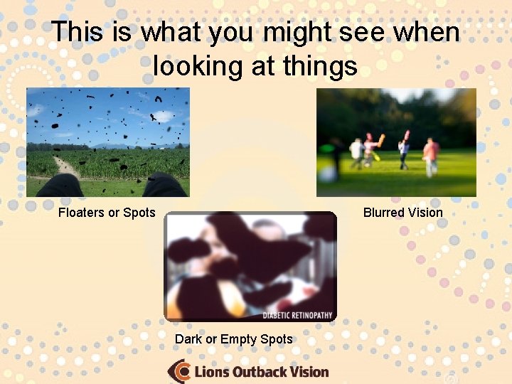 This is what you might see when looking at things Floaters or Spots Blurred