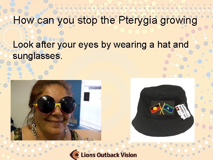 How can you stop the Pterygia growing Look after your eyes by wearing a
