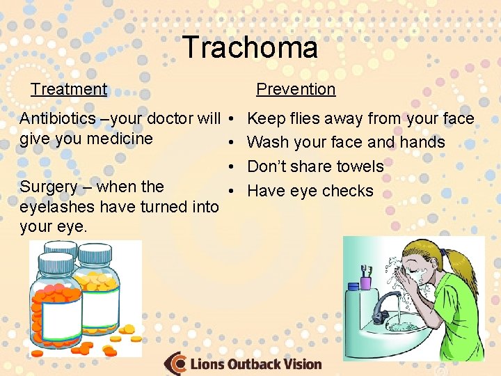 Trachoma Treatment Prevention Antibiotics –your doctor will • Keep flies away from your face