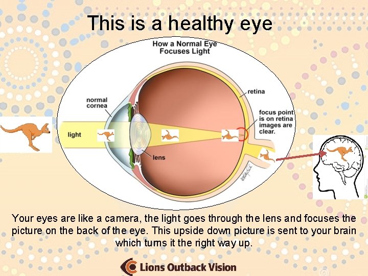 This is a healthy eye Your eyes are like a camera, the light goes