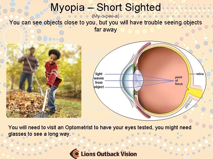 Myopia – Short Sighted (My-o-pee-a) You can see objects close to you, but you