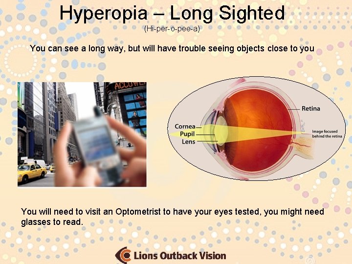 Hyperopia – Long Sighted (Hi-per-o-pee-a) You can see a long way, but will have