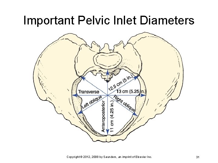Important Pelvic Inlet Diameters Copyright © 2012, 2008 by Saunders, an imprint of Elsevier
