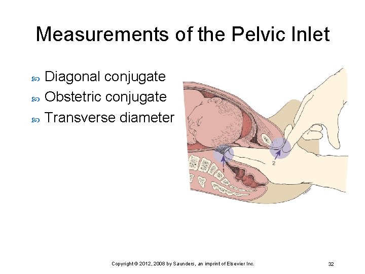 Measurements of the Pelvic Inlet Diagonal conjugate Obstetric conjugate Transverse diameter Copyright © 2012,