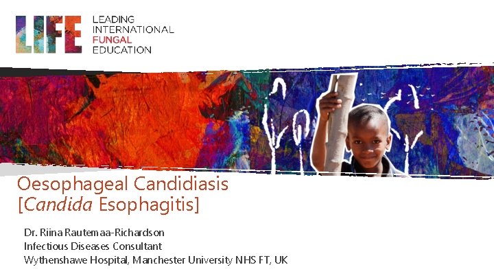 Oesophageal Candidiasis [Candida Esophagitis] Dr. Riina Rautemaa-Richardson Infectious Diseases Consultant Wythenshawe Hospital, Manchester University