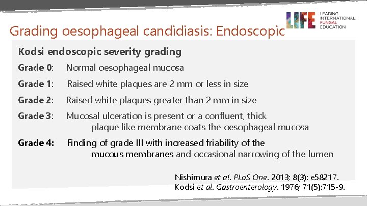 Grading oesophageal candidiasis: Endoscopic Kodsi endoscopic severity grading Grade 0: Normal oesophageal mucosa Grade