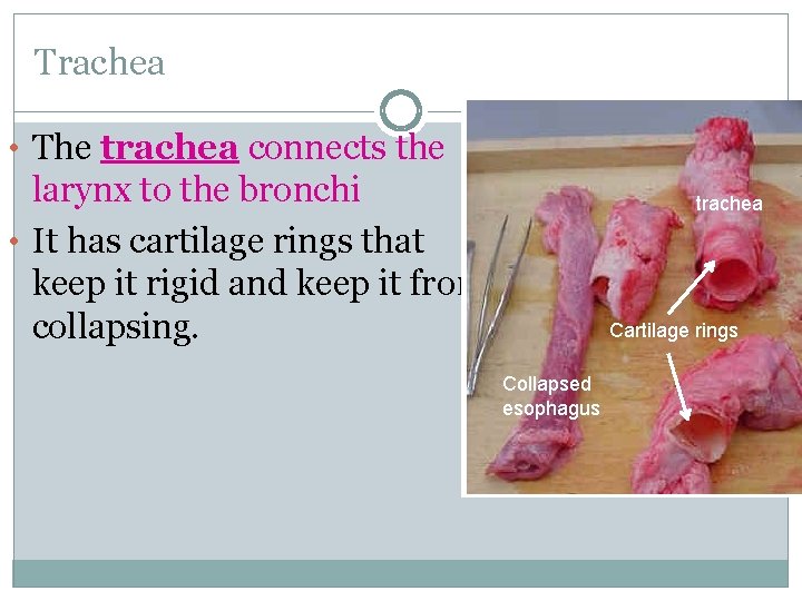 Trachea • The trachea connects the larynx trachea larynx to the bronchi • It