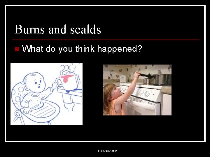 Burns and scalds n What do you think happened? First Aid Action 