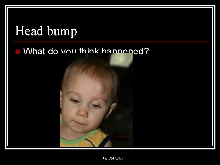 Head bump n What do you think happened? First Aid Action 