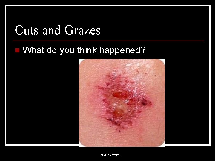 Cuts and Grazes n What do you think happened? First Aid Action 