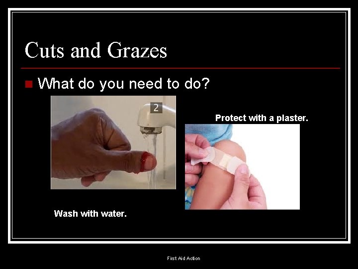 Cuts and Grazes n What do you need to do? Protect with a plaster.